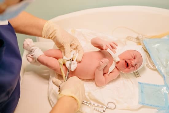 cordon umbilical recien nacido
