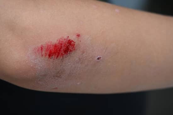 herida codo cicatriz